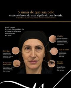 O Que Mais Envelhece o Rosto Não São Apenas as Rugas | Dra. Aneliza Vittorazzi | Medicina Regenerativa qualidade da pele envelhecimento facial dra aneliza vittorazzi ribeirao preto.jpg 3 | Dra. Aneliza Vittorazzi especialista em medicina regenerativa, alopecia androgenética e queimaduras