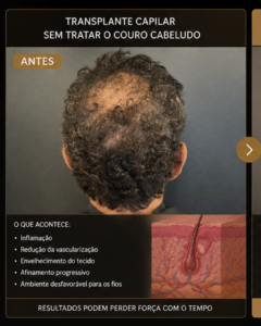 tratamento-regenerativo-couro-cabeludo-calvicie-regeneracao-capilar-dra-aneliza-vittorazz