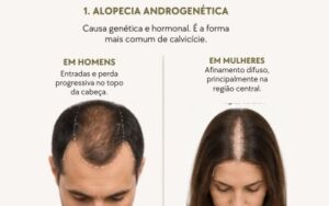 Como tratar a queda de cabelo